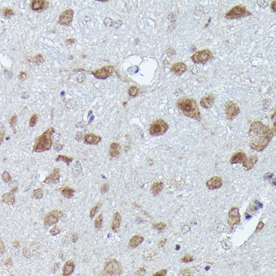 PFKFB3 Rabbit monoclonal antibody