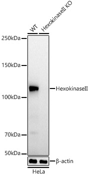[KO Validated] Hexokinase II Rabbit monoclonal antibody