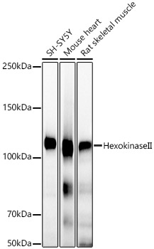 [KO Validated] Hexokinase II Rabbit monoclonal antibody