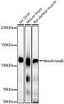 Western blot - [KO Validated] Hexokinase II Rabbit mAb (A22319)