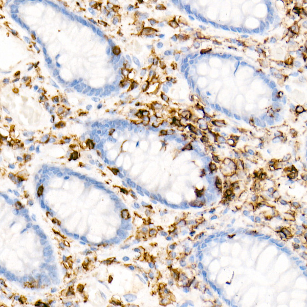 CD45 Rabbit monoclonal antibody
