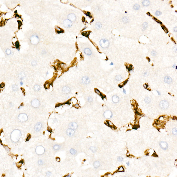 CD45 Rabbit monoclonal antibody