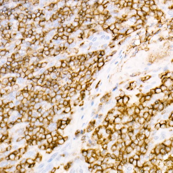 CD45 Rabbit monoclonal antibody