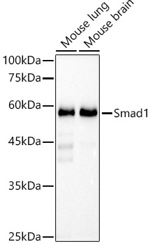 [KO Validated] Smad1 Rabbit monoclonal antibody