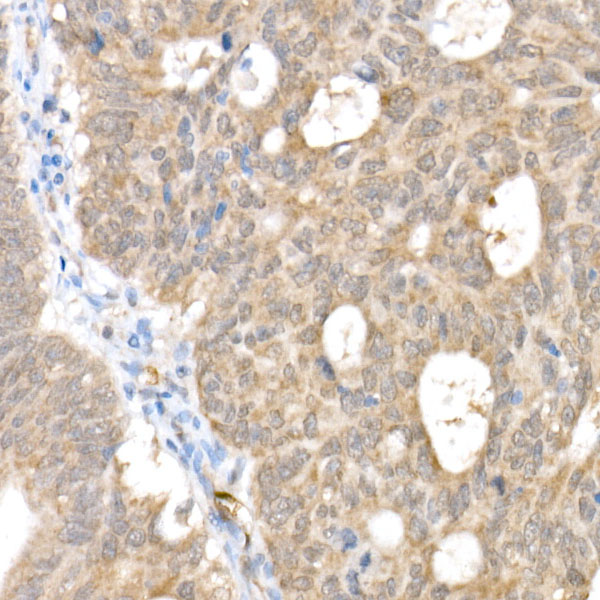 [KO Validated] Smad1 Rabbit monoclonal antibody
