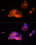 Immunofluorescence - MMP13 Rabbit mAb (A22334)