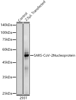 SARS-CoV-2 Nucleoprotein Rabbit mAb
