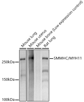 SMMHC/MYH11 Rabbit monoclonal antibody