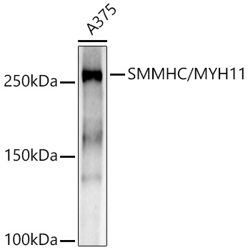 SMMHC/MYH11 Rabbit monoclonal antibody