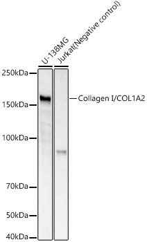 Collagen I/COL1A2 Rabbit mAb