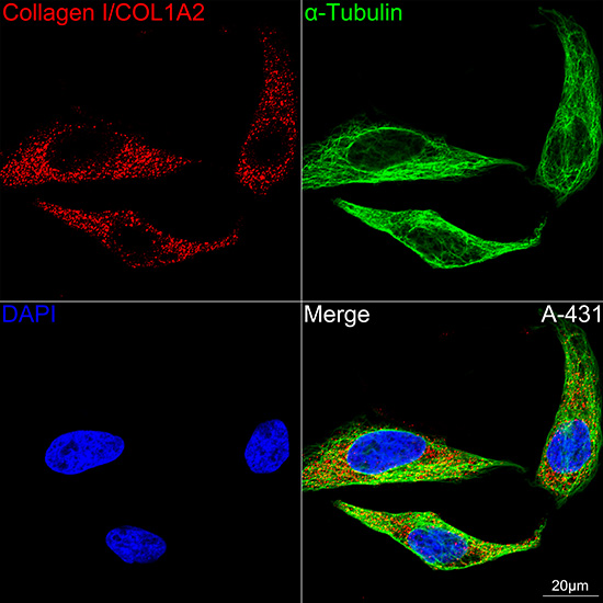 Collagen I/COL1A2 Rabbit monoclonal antibody