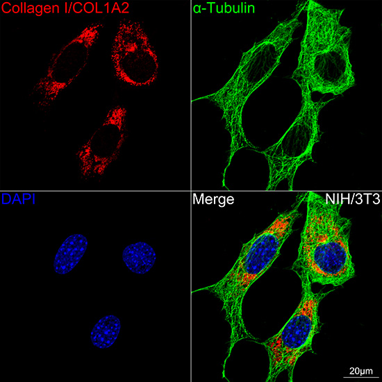 Collagen I/COL1A2 Rabbit monoclonal antibody