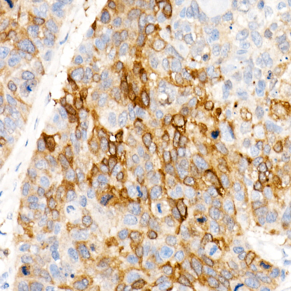 ALDH1A1 Rabbit monoclonal antibody