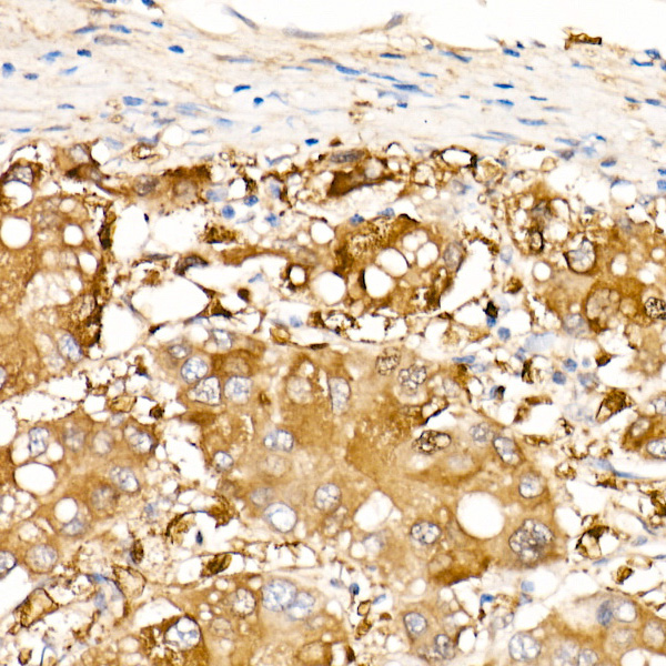 ALDH1A1 Rabbit monoclonal antibody