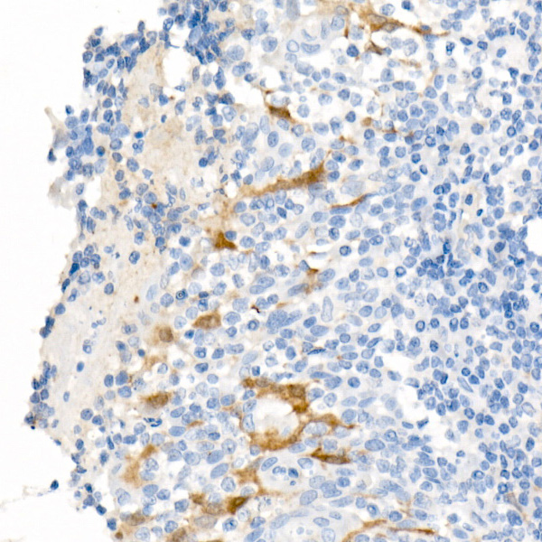 ALDH1A1 Rabbit monoclonal antibody