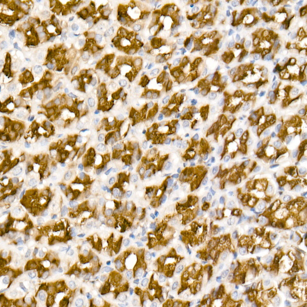 ALDH1A1 Rabbit monoclonal antibody