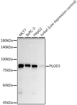 PLOD3 Rabbit monoclonal antibody
