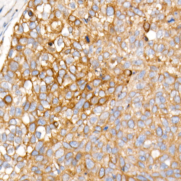 PLOD3 Rabbit monoclonal antibody