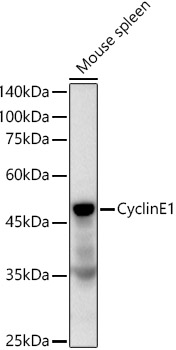 Cyclin E1 Rabbit monoclonal antibody