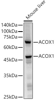 ACOX1 Rabbit monoclonal antibody