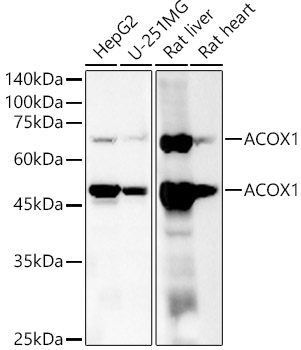 ACOX1 Rabbit monoclonal antibody
