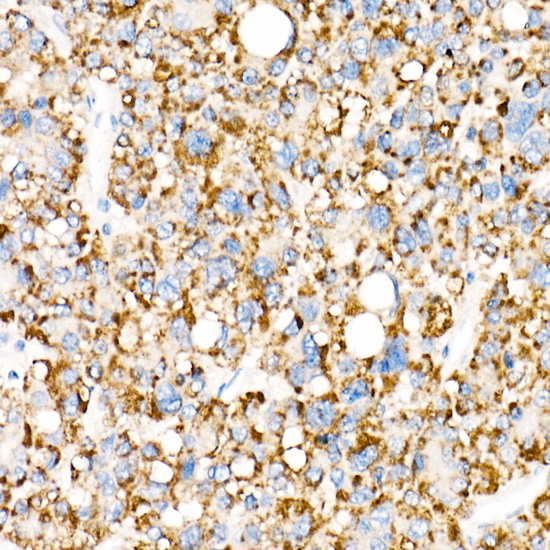 ACOX1 Rabbit monoclonal antibody