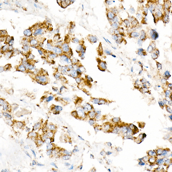 ACOX1 Rabbit monoclonal antibody