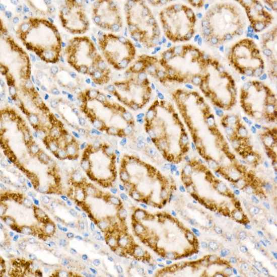 ACOX1 Rabbit monoclonal antibody
