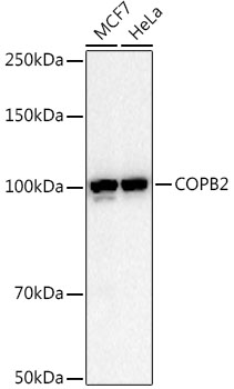 COPB2 Rabbit monoclonal antibody