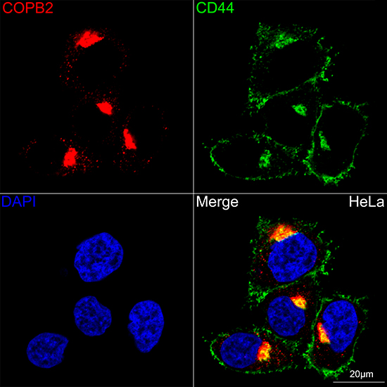 COPB2 Rabbit monoclonal antibody