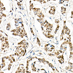 Western blot - Progesterone Receptor Rabbit mAb (A22392)