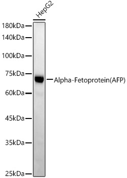 Alpha-Fetoprotein (AFP) Rabbit monoclonal antibody