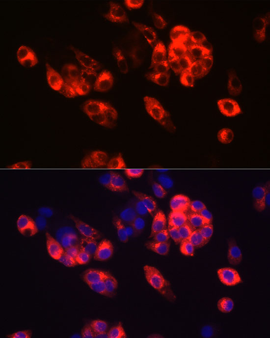 Alpha-Fetoprotein (AFP) Rabbit monoclonal antibody