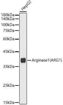 Arginase 1 (ARG1) Rabbit mAb