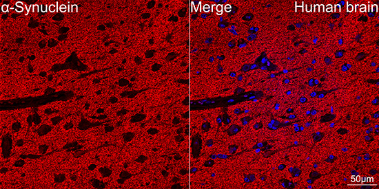 A Alpha-Synuclein Rabbit monoclonal antibody