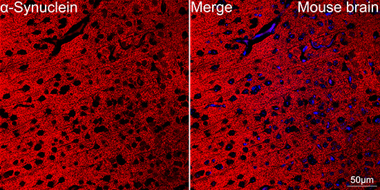 A Alpha-Synuclein Rabbit monoclonal antibody