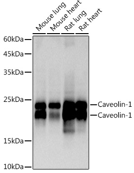Caveolin-1 Rabbit monoclonal antibody