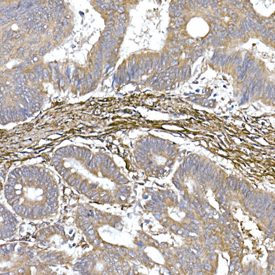 Caveolin-1 Rabbit monoclonal antibody