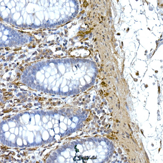 Caveolin-1 Rabbit monoclonal antibody