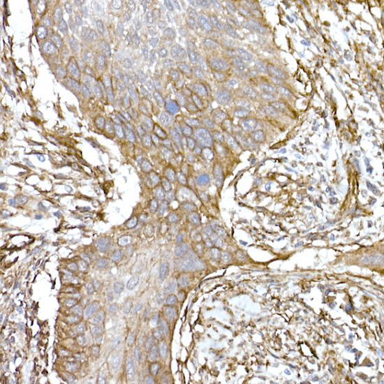 Caveolin-1 Rabbit monoclonal antibody