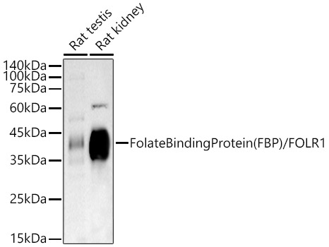 Folate Binding Protein(FBP) / FOLR1 Rabbit monoclonal antibody