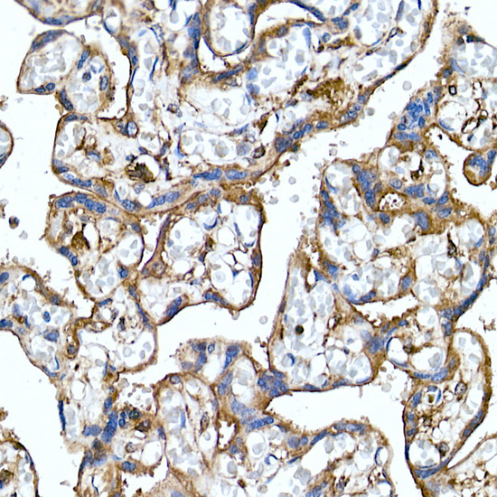 Folate Binding Protein(FBP) / FOLR1 Rabbit monoclonal antibody