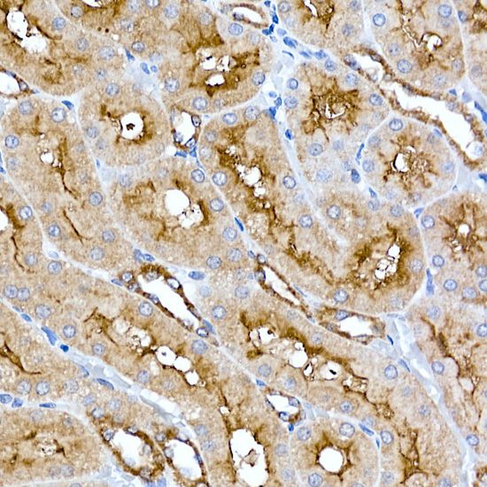 Folate Binding Protein(FBP) / FOLR1 Rabbit monoclonal antibody