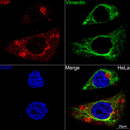 Folate Binding Protein(FBP) / FOLR1 Rabbit monoclonal antibody
