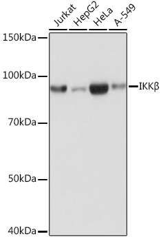 IKKB Beta Rabbit monoclonal antibody