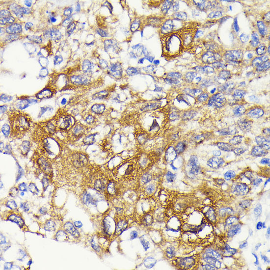 IKKB Beta Rabbit monoclonal antibody