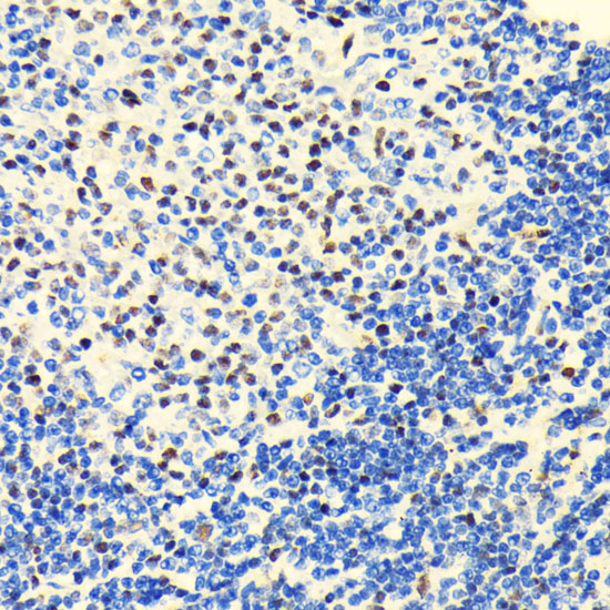 HDAC2 Rabbit monoclonal antibody