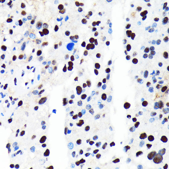 HDAC2 Rabbit monoclonal antibody