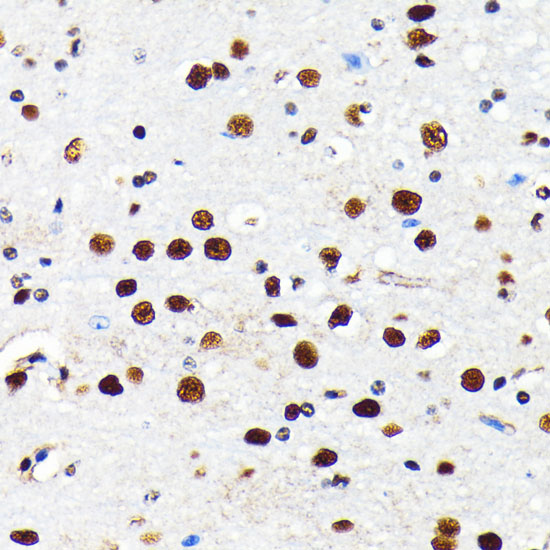 HDAC2 Rabbit monoclonal antibody