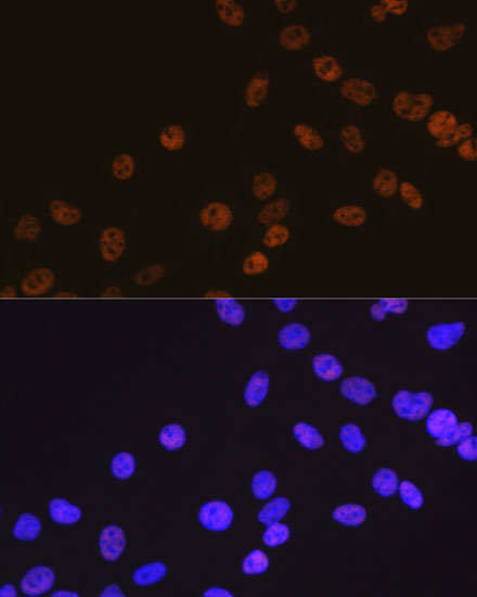 HDAC2 Rabbit monoclonal antibody